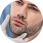 beard hair transplant
