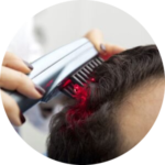 laser hair treatment image