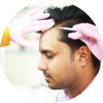 hair treatment