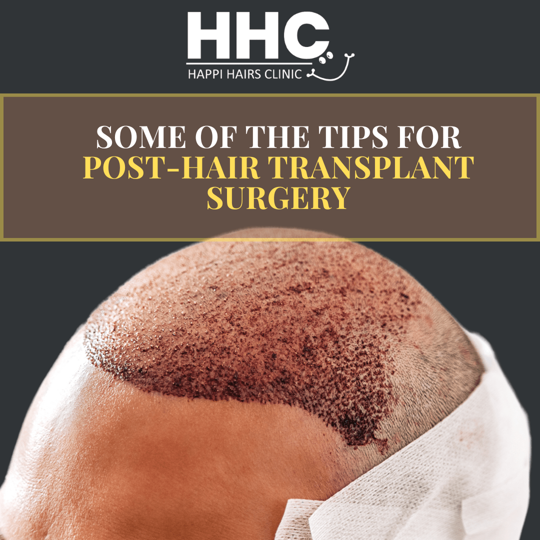 Hair Transplant Surgery